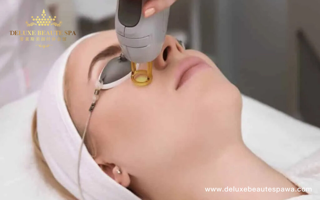 Freckle-removal-treatment