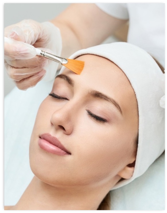 Chemical Peels Facial